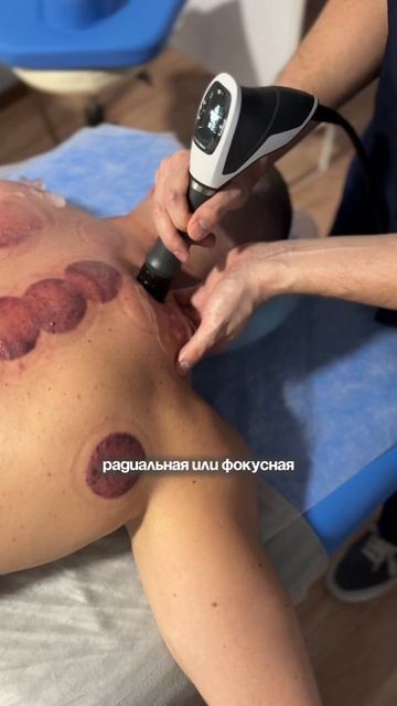 Ударно-волновая терапия в T&M clinic