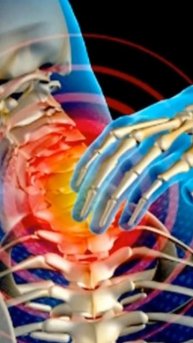 Как убрать отложения солей на шее.