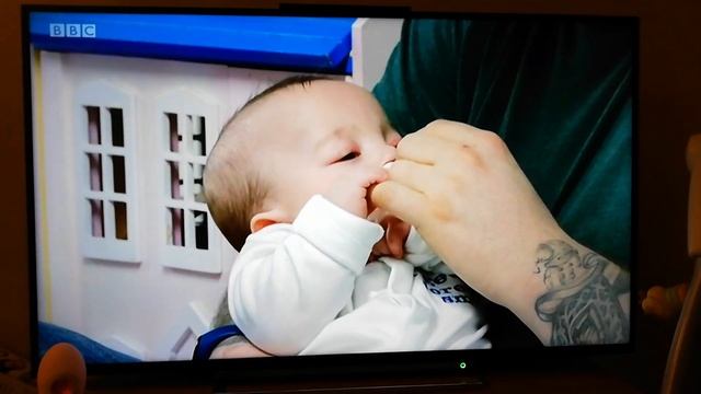 BBC Look North cleft lip and palate