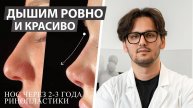 Нос через 2-3 года после ринопластики