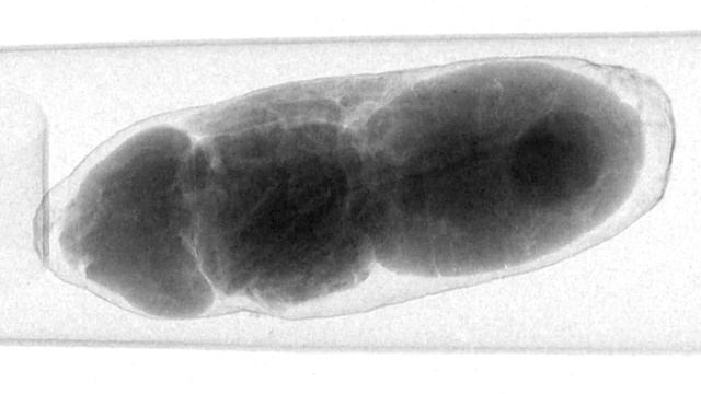 micro-CT Scan of a Fly Pupa Hatching