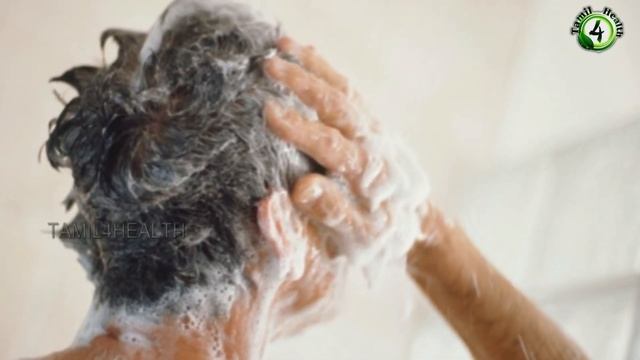 ஆண்களே முடி கொட்டுறப்ப இதெல்லாம் செய்யாதிங்க(HAIR LOSS TAMIL)