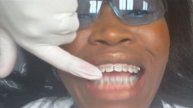 {#31}: AT THE ORTHODONTIST OFFICE ON 3-16th-2011: BRACES APPOINTMENT.