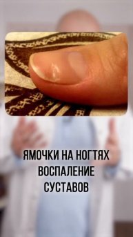 Проверь свои ногти! Диагностика по ногтям #shorts
