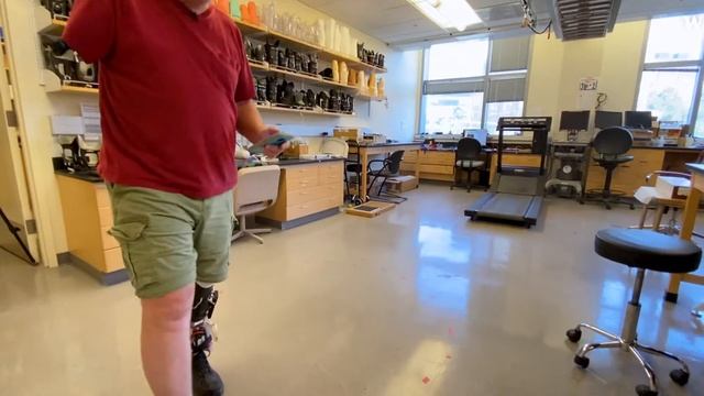 Finding the perfect prosthetic fit - Sanders UW Research Labs