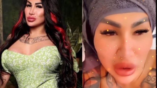 JASMINA TRANS OG'IR AXVOLDA!!! SHOK XABAR