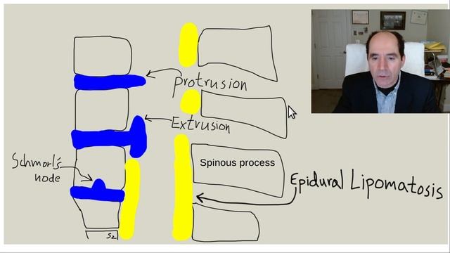 What is a Western Abdomen diseases