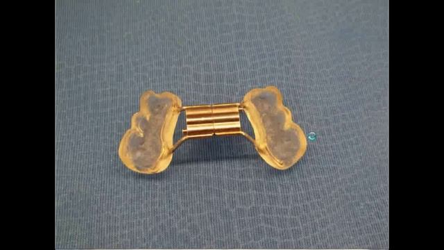 Fixed Upper Orthodontic Expanders | Fixed Upper Expander Labs | Fixed Applaince Labs