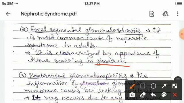Nephrotic Syndrome - Causes ( Nursing Lecture in Hindi MSN Part 1 )