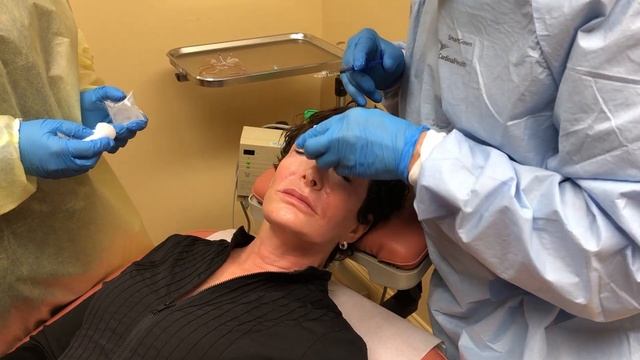 Lauri Kane Uses Filler and NewTox to Smooth the "11" Lines of Her Brow