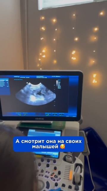 Видели котят на УЗИ?