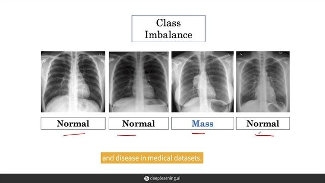 Practical Challenges Training with Medical Data (AI For Medicine)