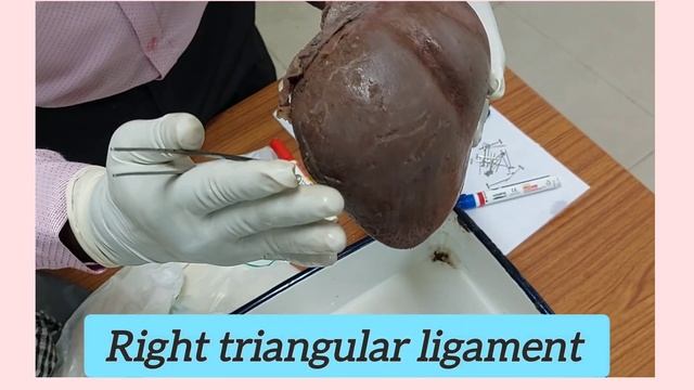 Liver l Ligaments l True & False ligaments
