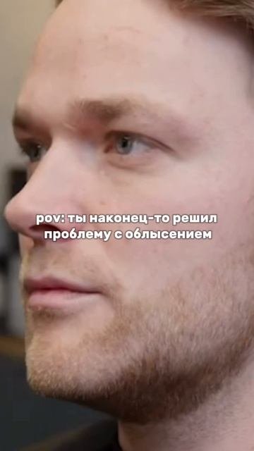 Система волос