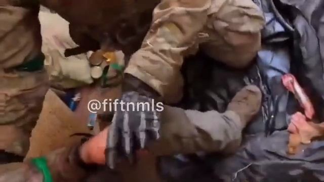 Торецк. АЗОВцу с погонялом Авель отстрелили пятак!