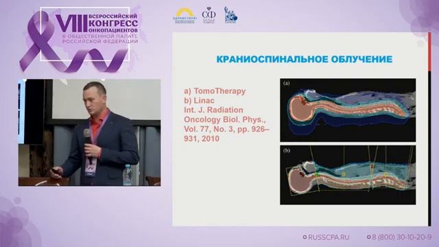 Томотерапия — инновационный метод лучевой терапии