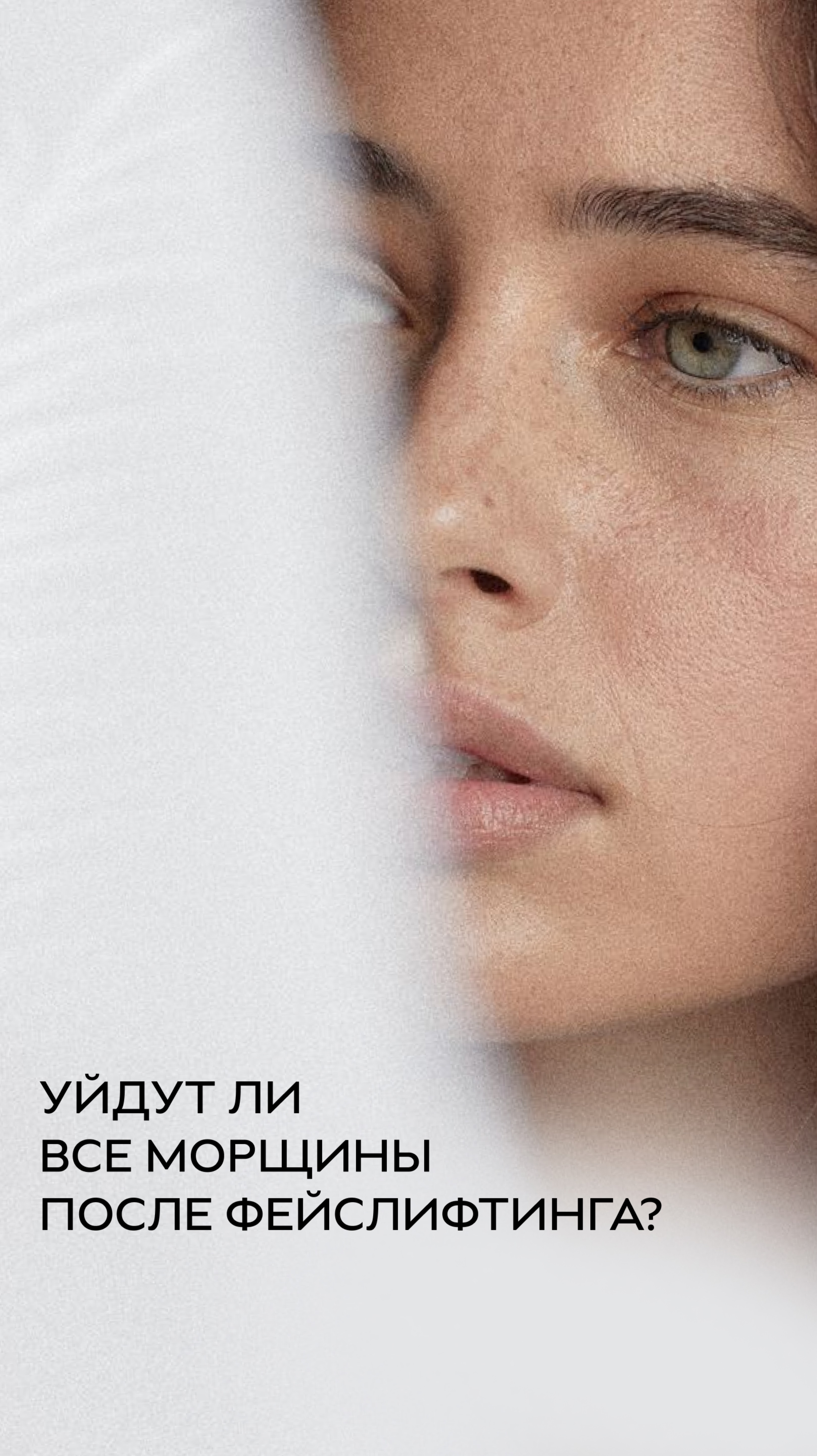 Уйдут ли все морщины после фейслифтинга?