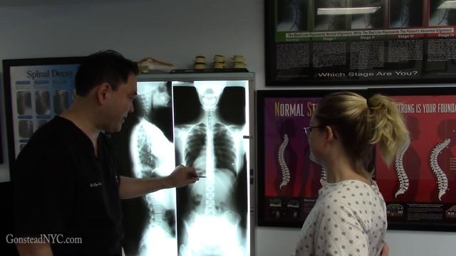 Nurse with numbness and tingling at the ribs - FIXED Gonstead Chiropractic