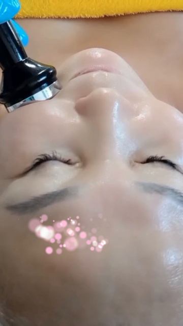 РФ лифтинг лица