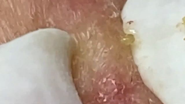 Enjoy Your Day With LN Spa #7448