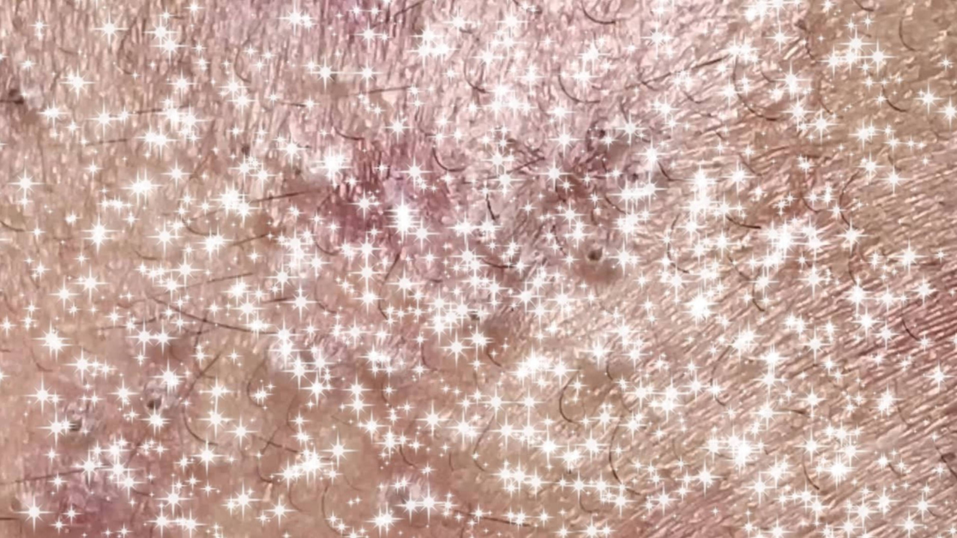 Механическая чистка лица