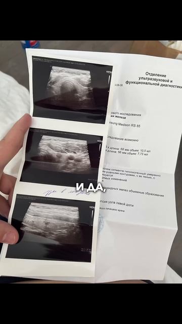 Вот к чему меня привел лишний вес