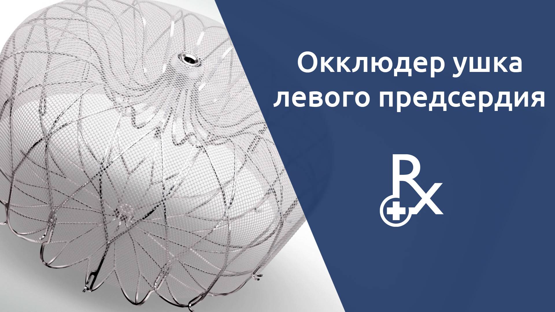 Имплантация окклюдера ушка левого предсердия.