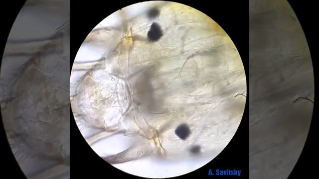 Голова личинки из прошлого видео 630х /Head of the larva from the past video 630x