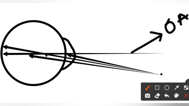 Ocular axis and its angles | angle alpha,  angle gamma,  angle kappa |#optometry