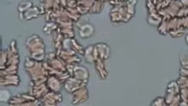 Глисты паразиты в кровиизбавлениепрофилактика YouTube