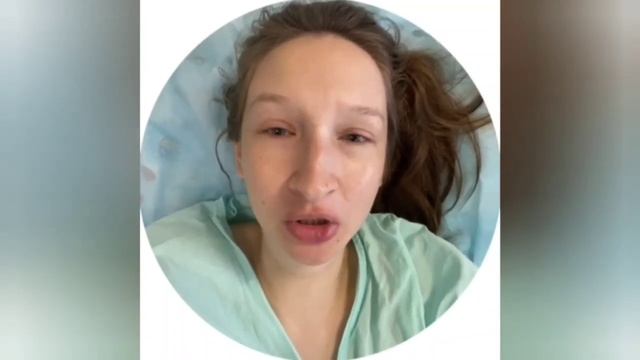 ЕР после 2 КС