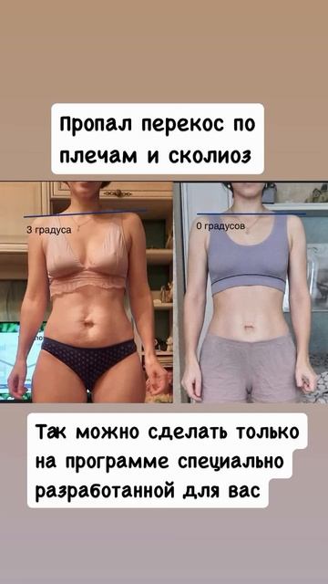 Хочешь убрать боли в спине и исправить осанку, пиши мне слово СПИНА и я подготовлю для тебя занятия