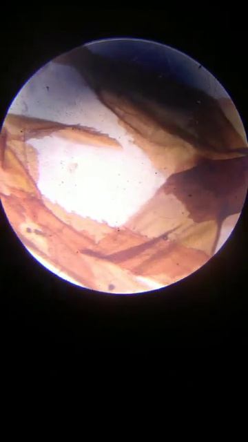 sphagnum (moss)_ bryophyta under microscope