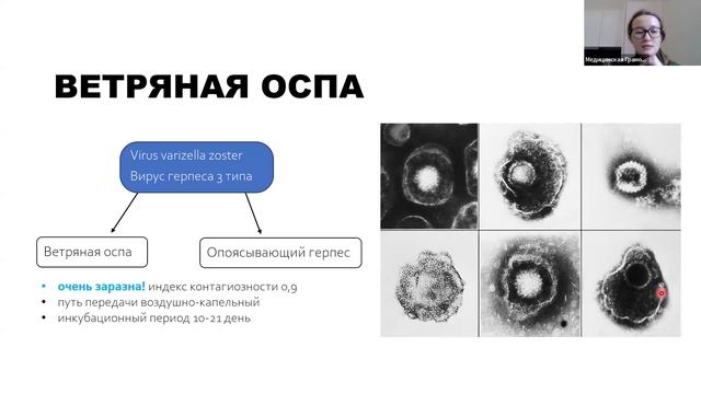 4 Инфекционные сыпи