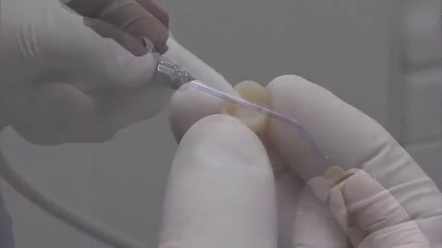 Calibra Universal Crown Surface Preparation