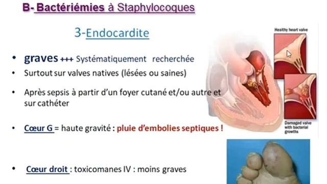 Infections à STAPH Dr Abdellah