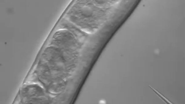 Transgenic injection of C. elegans worm