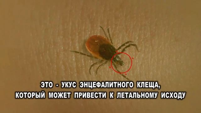 Клещи