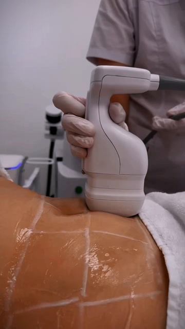 Liposonix (липосоник)