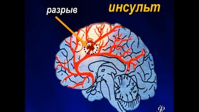 Всемирный день без табака