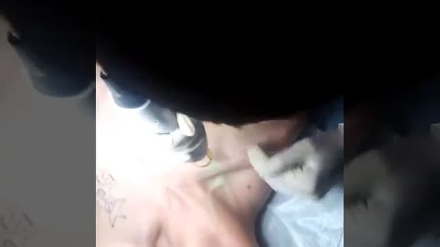 Kişilər Üçün Sinə və Qarın  Lazer Epilyasiyası