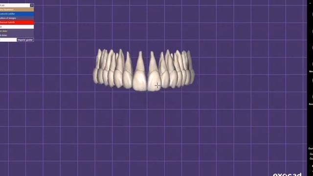 Exocad handcrafted rooted tooth design