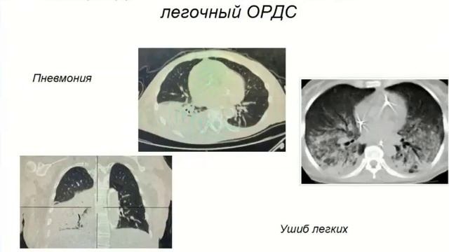 30 лет рекрутменту используем или нет Левиков Д.И. ЖКС 2022