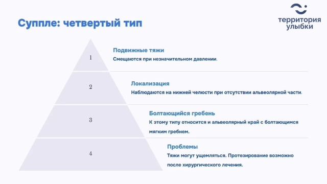 Суппле