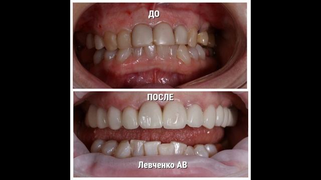 Слайд работы до после