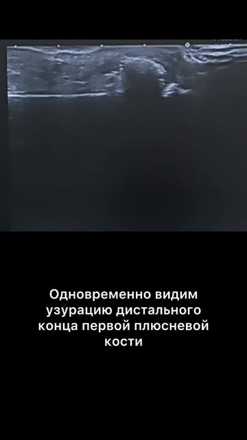 #тофус