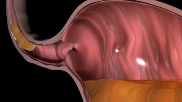 Эти ЗАВТРАКИ убивают ваше ЗДОРОВЬЕ! #тибетскаямедицина #докторжимба