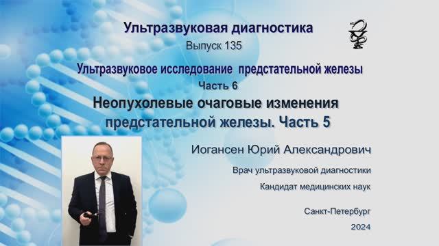УЗИ. Доктор Иогансен. Выпуск 135. Неопухолевые очаговые образования предстательной железы. Часть 5.