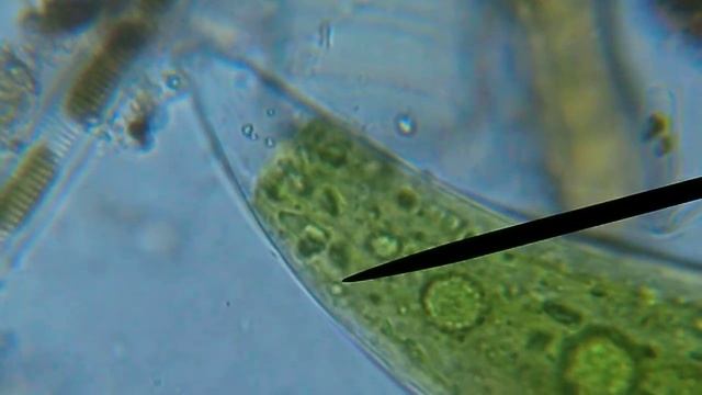 closterium