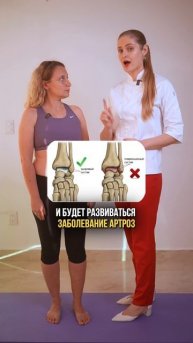 Пиши «Хруст» в комментариях и получи полезную информацию, как избавиться от хруста суставов